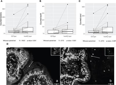 Crohn’s disease recurrence updates: first surgery vs. surgical relapse patients display different profiles of ileal microbiota and systemic microbial-associated inflammatory factors